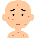老人性血管腫